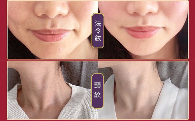 056913e47159a914973ca647921067c7 FACIAL抗皺美白精華液