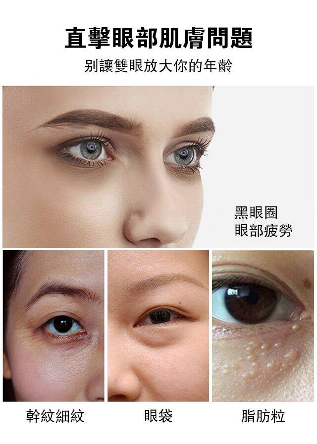11ded07e238bb225fa0390bc38cb0611 脂肪粒祛除精華液