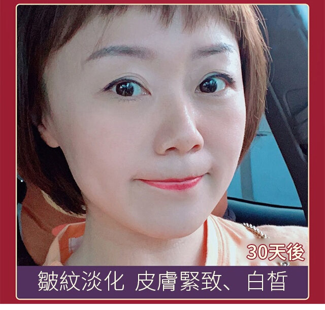 3026b593b827cbc9dfdf0e999a5d0e2f FACIAL抗皺美白精華液