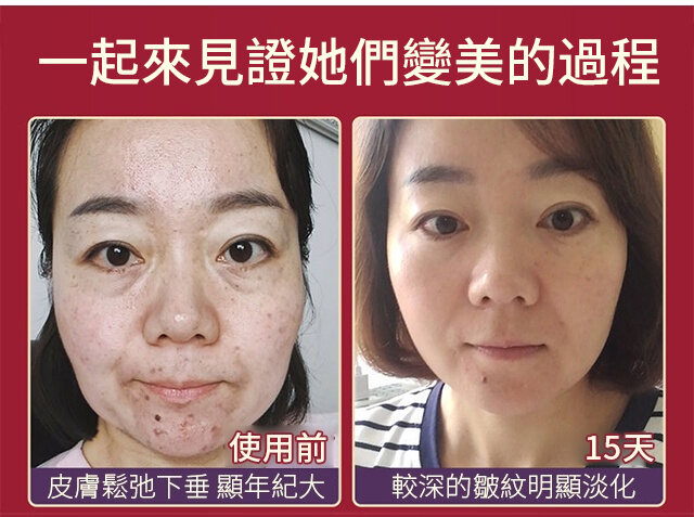 44b6fcbcbc5531149f20efba2b9bf3a2 FACIAL抗皺美白精華液