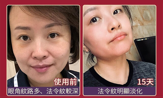4645fdd4f02c619023684054dc68f922 FACIAL抗皺美白精華液