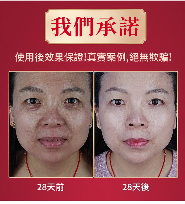 50c3293d3ad582f898855fcc21292d23 FACIAL抗皺美白精華液