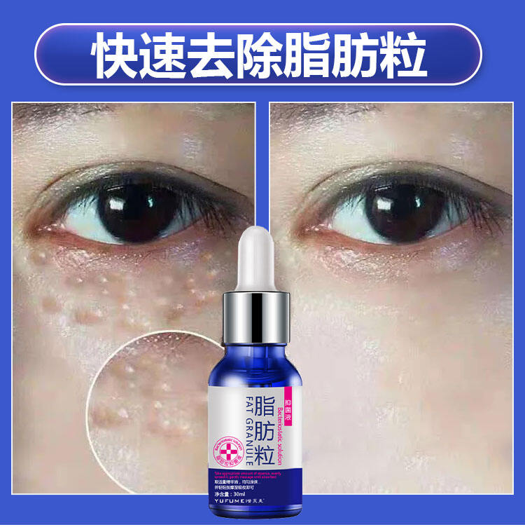 64d7aeccfdbfe314b377397ff9b8b9fc 脂肪粒祛除精華液