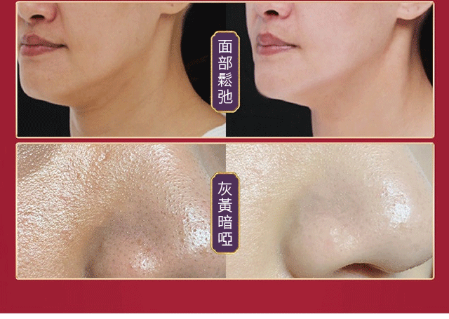 8199a8c8b44dd6354c1d1af5dc7288a4 FACIAL抗皺美白精華液