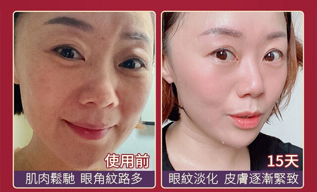 90ae575e806847e2c67008771e2416dd FACIAL抗皺美白精華液