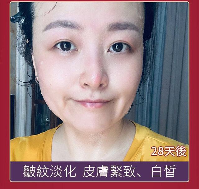 9b644ea89046644508e96fea309b0247 FACIAL抗皺美白精華液