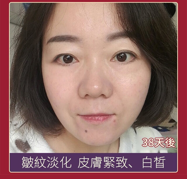 c1e02a23ae25ccbb6ba78385e97f16c7 FACIAL抗皺美白精華液